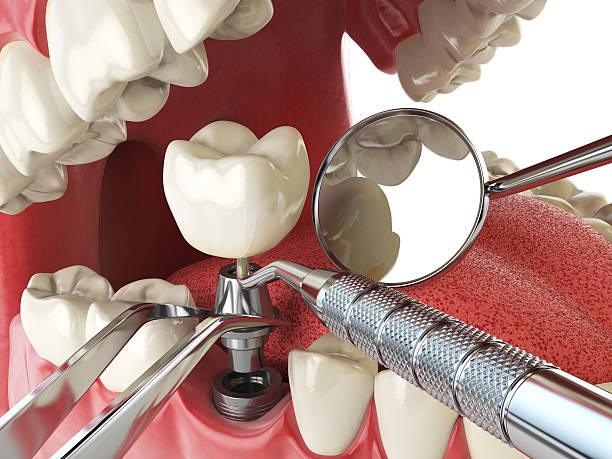 Best Emergency Dental Care for Broken or Chipped Teeth in Eagle River, WI